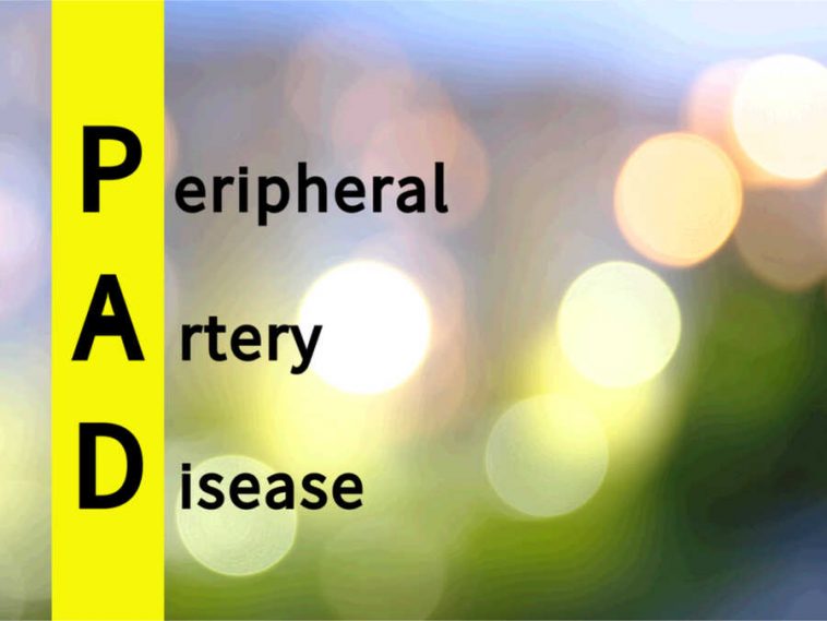 treat peripheral arterial disease