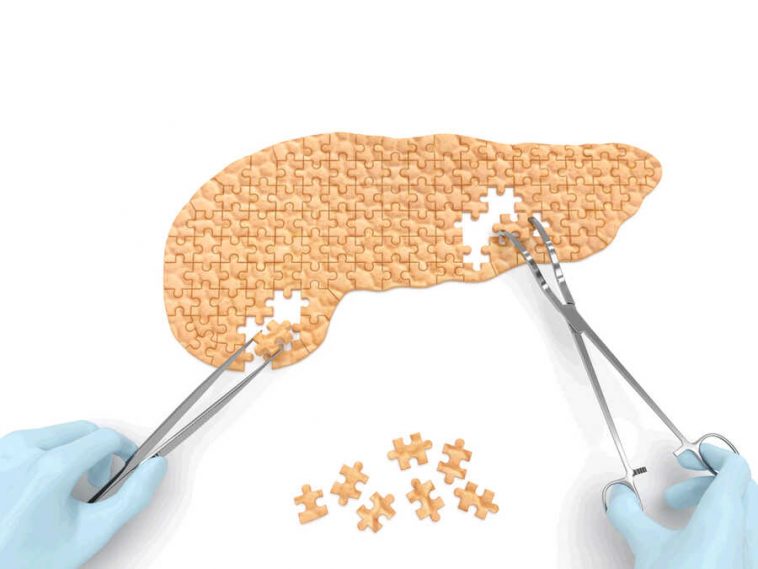 metformin and cancer